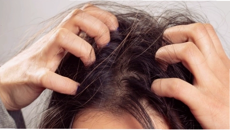 Dấu hiệu nhận biết tóc sâu chính xác nhất